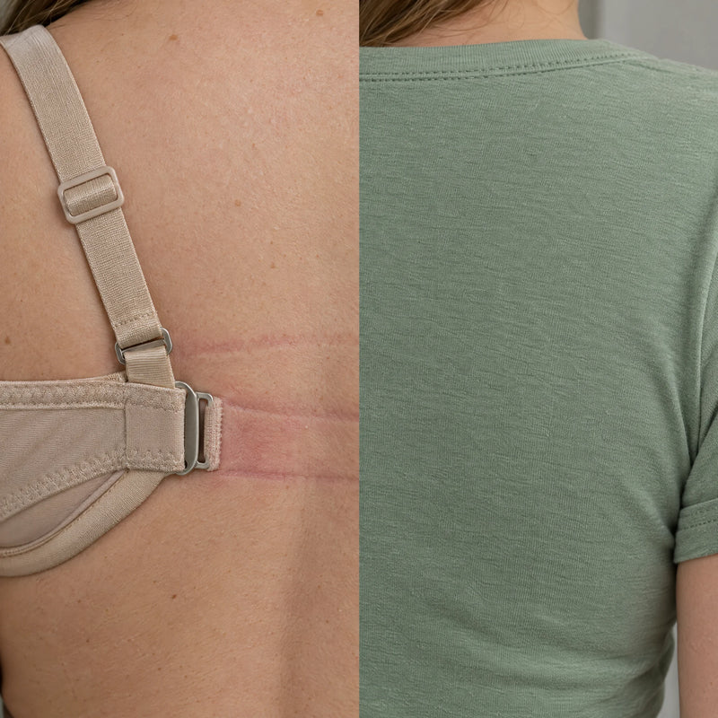 A bra clasp and strap slider marking the skin, beside the smooth shoulder of the tee